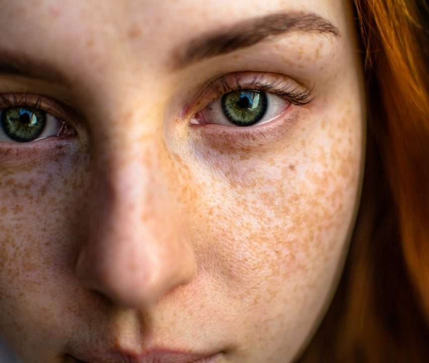 為什麼皮膚會突然變差？改善生活習慣完整指南
